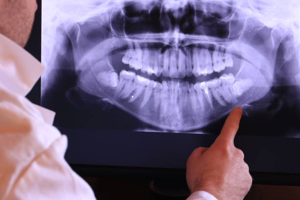 Best Emergency Root Canal Therapy in Lumberton, MS