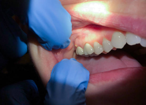 Best After-Hours Dental Care in Lumberton, MS