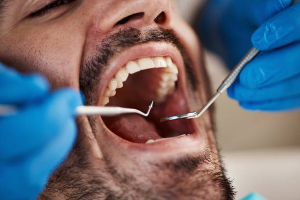 Best Emergency Root Canal Therapy in Lumberton, MS