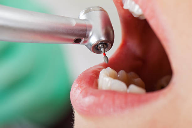 Best Emergency Dental Care for Sports Injuries in Lumberton, MS